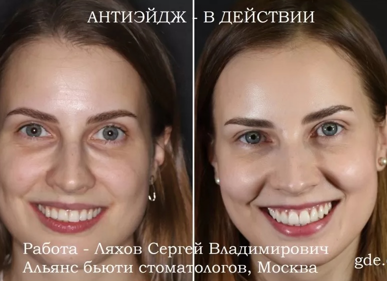 Алья снова всё испортила: что покажут в 49 серии «Далёкого города»